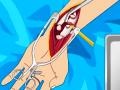 Igra Arm surgery 2