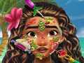 Igra Moana Skin Doctor