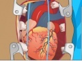 Igra Heart Surgery
